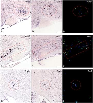 Parvalbumin-Neurons of the Ventrolateral Hypothalamic Parvafox Nucleus Receive a Glycinergic Input: A Gene-Microarray Study